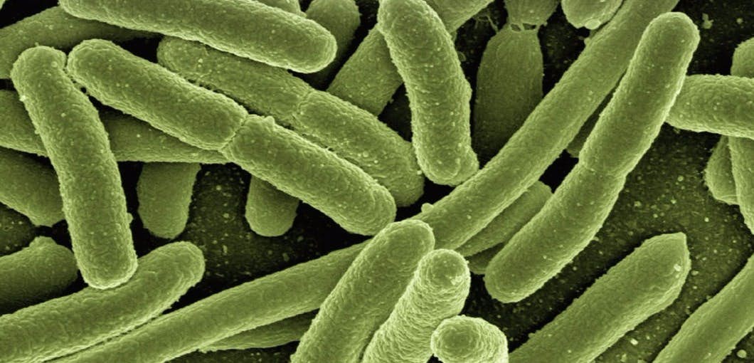 Could E. Coli Bacteria be Both a Cancer CAUSE and a Cancer CURE? about undefined