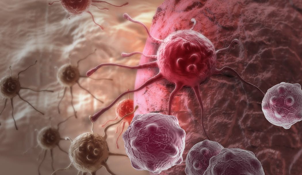 Cancer Can Be Deadly… But Probably Not for the Reason You Think about undefined