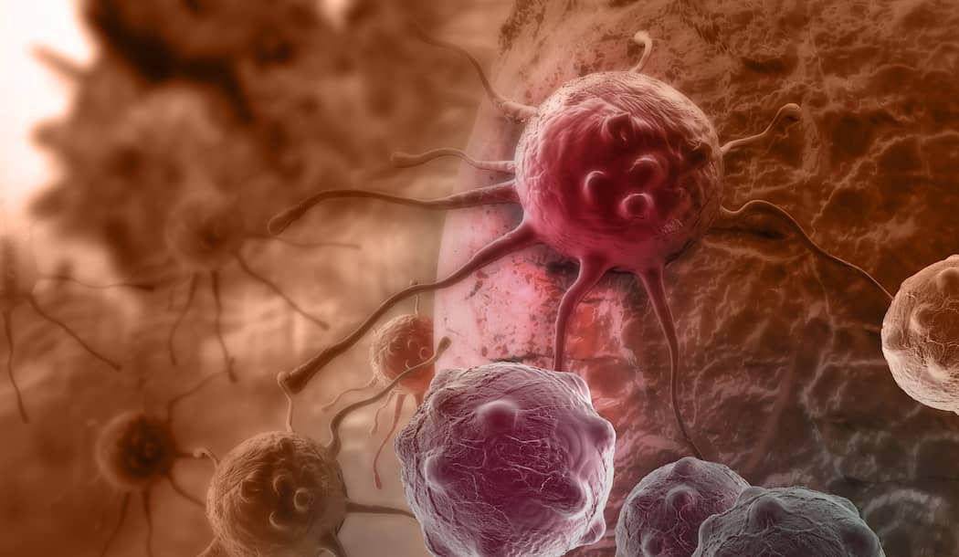 The 10 Point Plan for Preventing Cancer about undefined