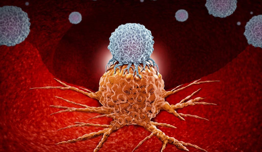 Fight Cancer with Super-Charged “Bionic” Immune Cells about false