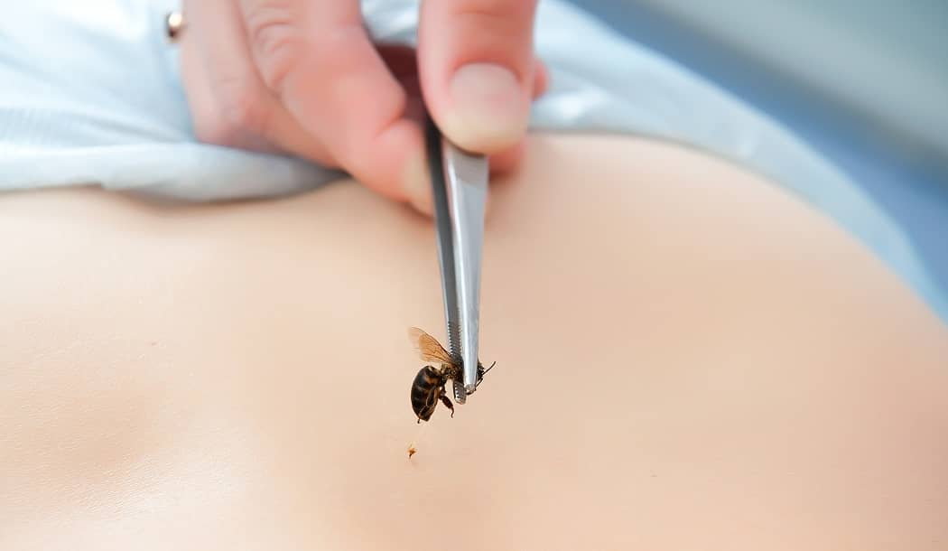 Bee Venom Takes the Sting Out of Cancer about undefined