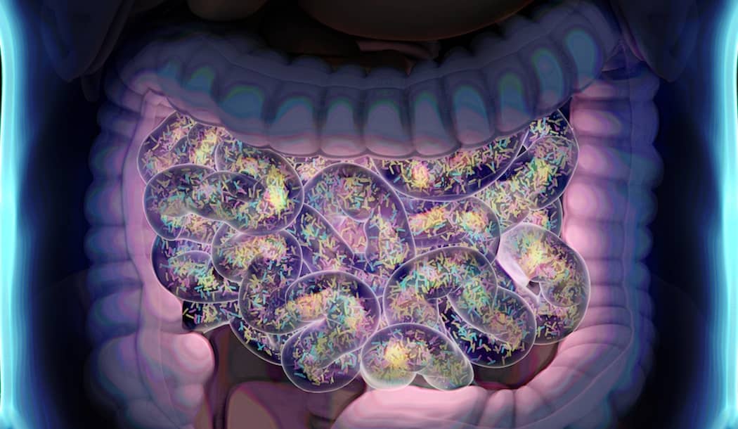 One Key to Successfully Treating Prostate Cancer about undefined