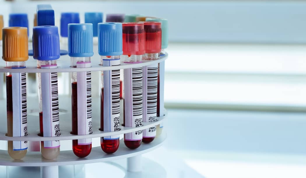 Turn Your Blood into an Anti-Cancer Elixir about undefined