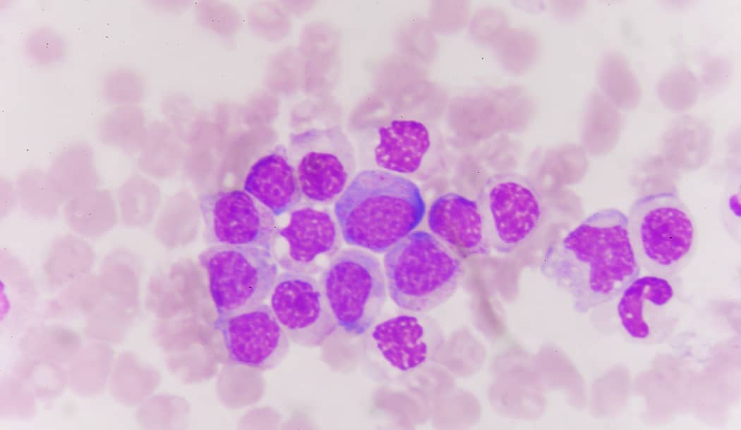 When Cancer Is A Microbial Infection… about undefined